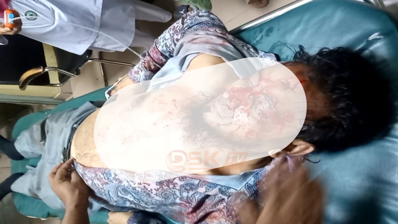 ইসলামী ব্যাংকের গ্রাহকদের শান্তিপূর্ণ মানববন্ধনে পুলিশের হা'মলা গু'লিবিদ্ধ-৫০আ'হত শতাধিক